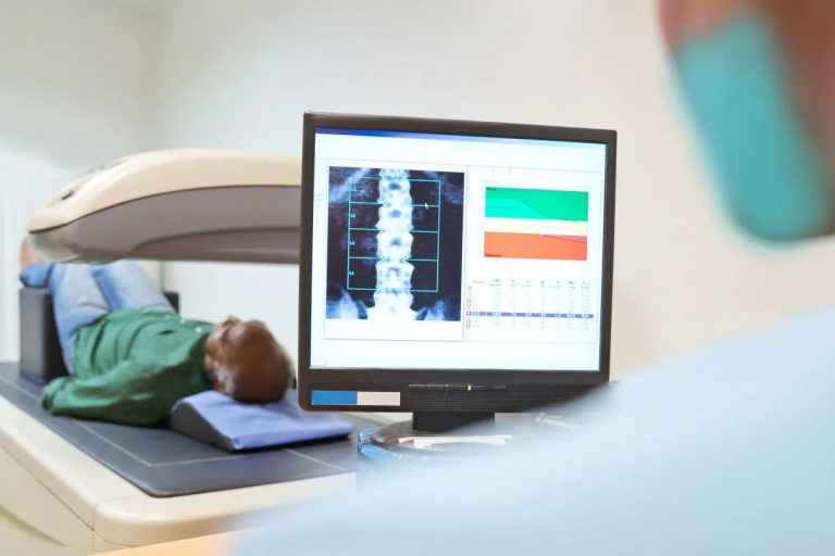گزارش BMD به روش DXA و نکات مهم در ارزیابی و تحلیل آن